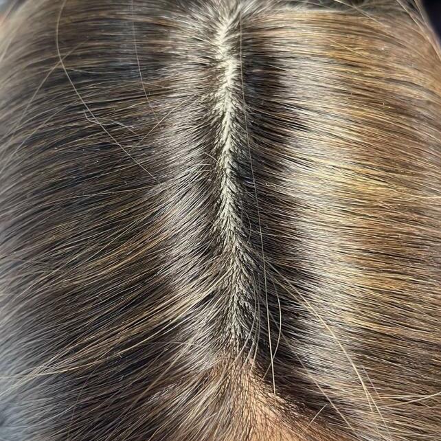 Custom Human Hair Hand Tied Form Fitted to Client.  Color Highlights to Spec.  Medical wig cranial prosthesis